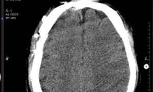 40 chiếc đinh vít tái tạo gương mặt người đàn ông